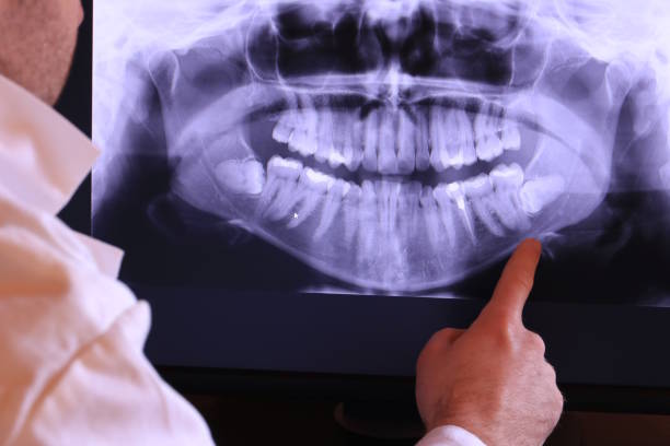Best Emergency Treatment for Jaw Pain or Injury in Temesl Valley, CA